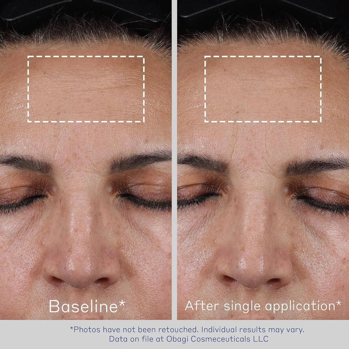 OBAGI ELASTIderm Adanced filler concentrate 20ml. NYHET!